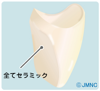 オールセラミック