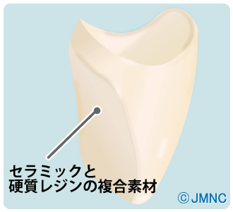 ハイブリッド